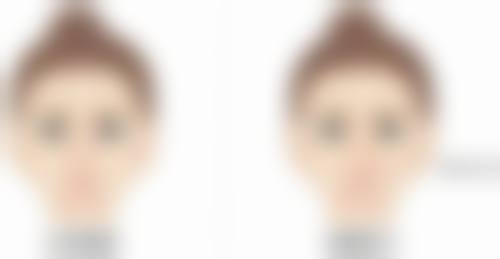 手术的风险和注意事项