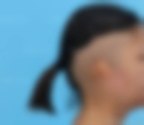 【孝感华美医疗美容门诊部北京路店参考价格表:】