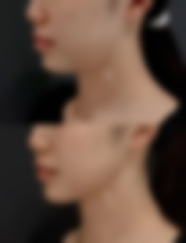 徒手阴道紧缩手术是怎么做的？揭秘手术全过程，了解4大步骤与3大优势，让你重拾紧致生活！ 