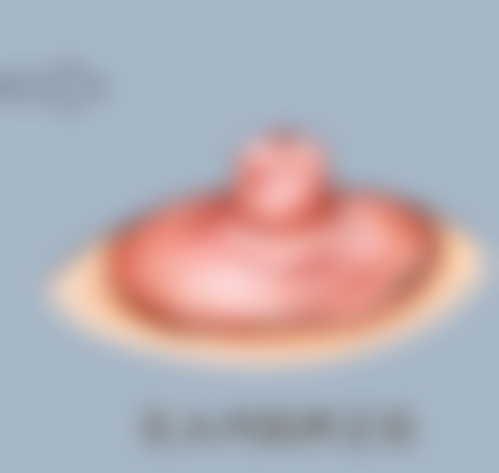 玻尿酸丰太阳穴维持多久