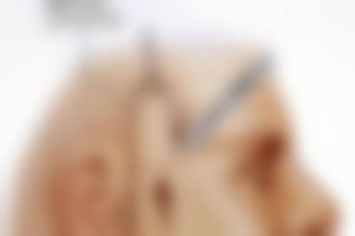 如何延长玻尿酸丰太阳穴的成效