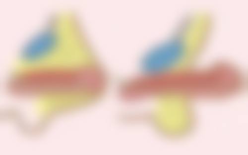 玻尿酸丰太阳穴的注意事项