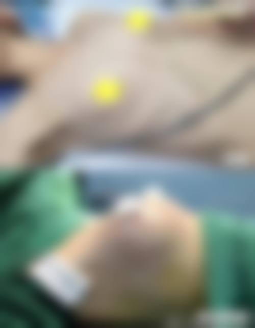 【南宁贞韩医疗美容门诊部参考价格表:】