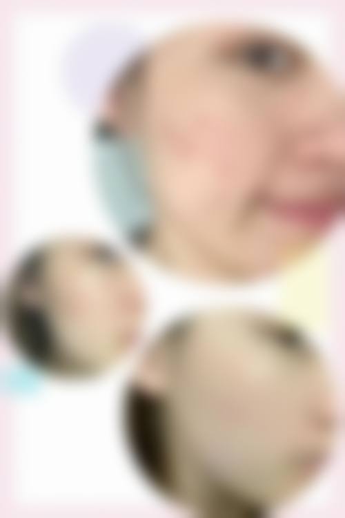 【王志明医生擅长项目】