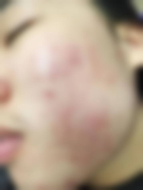 【王志明医生口碑怎么样?】