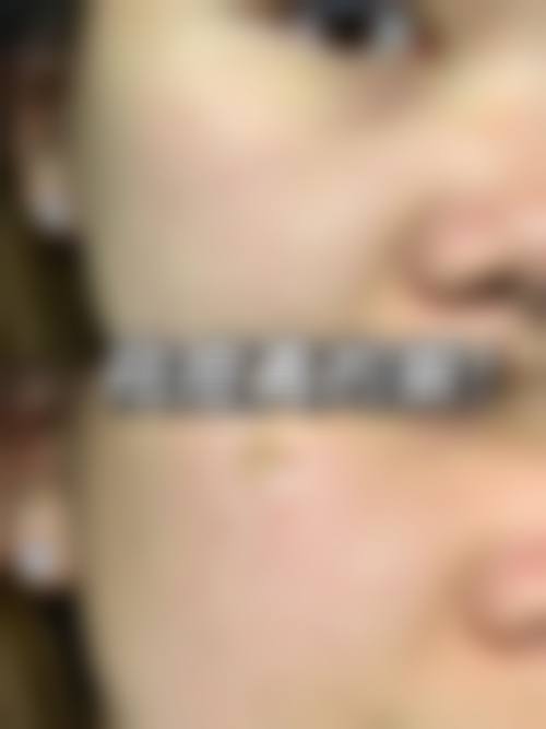 【王志明医生技术特点】