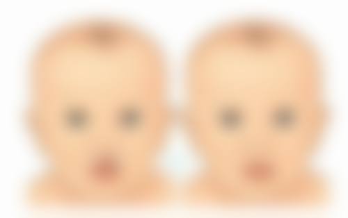 打除皱针对皮肤有影响吗？揭秘3大积极影响，让你轻松拥有光滑紧致肌肤，开启逆龄之旅！ 