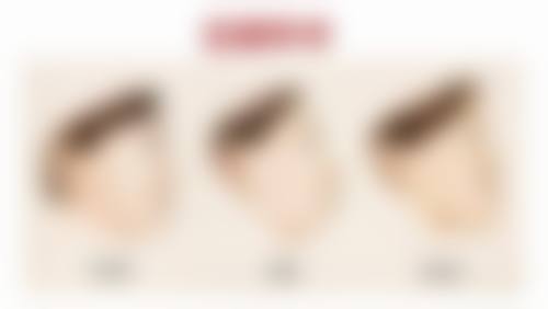 【黄莉雯医生技术特点】