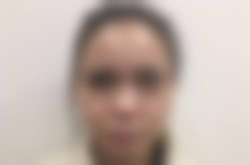 （二）术后并发症及处理方法