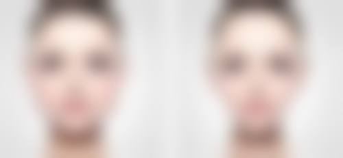 瘦脸针要多长时间打一次？掌握正确间隔时间，3次让你拥有紧致小V脸，效果持久不反弹！ 