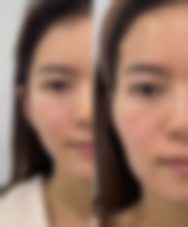 【重庆斯启诺皮科诊所诊疗设备:】