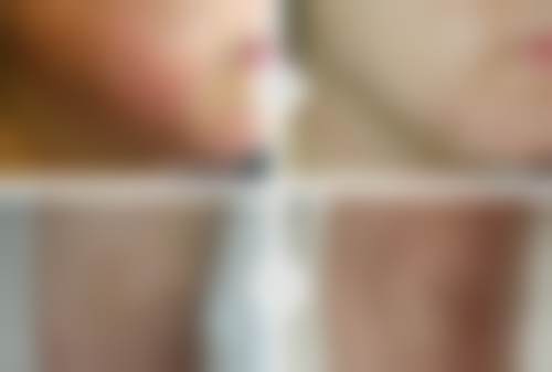 【韩国鸣玉轩韩医院患者口碑评价：】