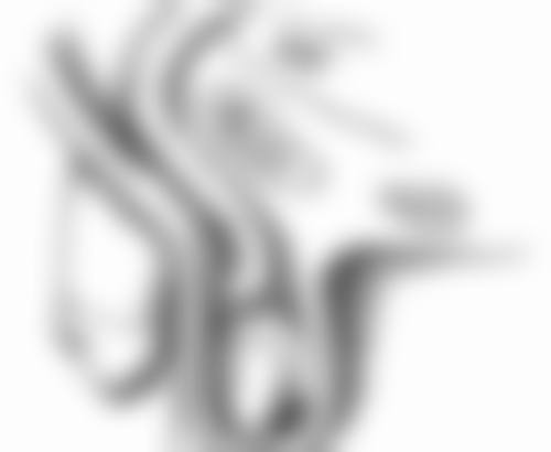 瘦脸针打完多久见效