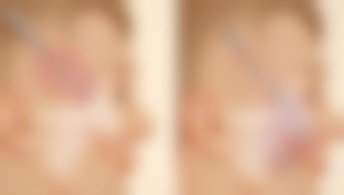 打瘦脸针多长时间可以喝酒