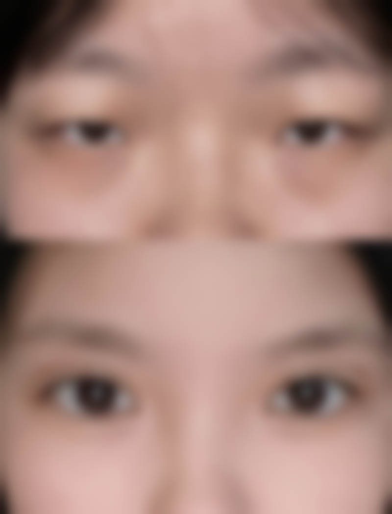 【刘引兰医生擅长项目】