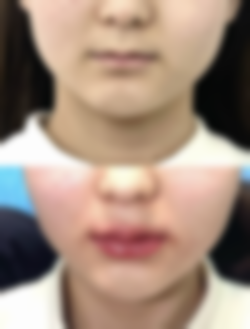 【韩国鸣玉轩韩医院参考价格表：】