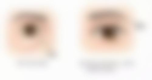 瘦脸针打几次就不用再打了