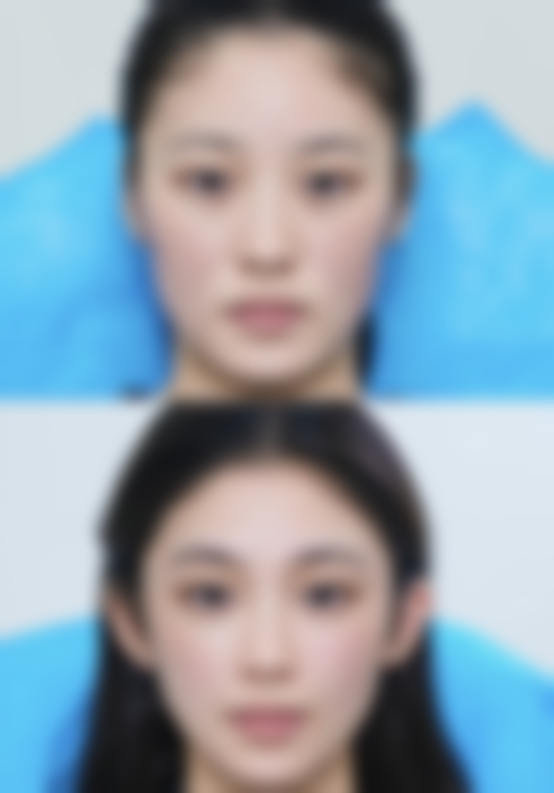 种植头发能生长吗