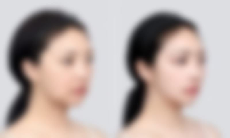 【宁波江东天使医疗美容门诊部是正规的吗?】