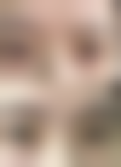 【临沂梦夏医学美容诊所患者口碑评价：】