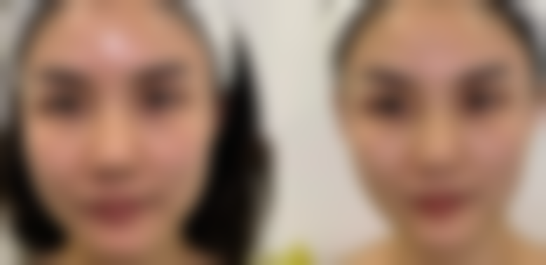 【衢州市人民医院(医疗美容科)是正规的吗?】