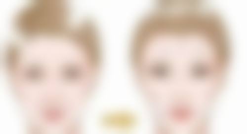 疤痕种植头发成活率