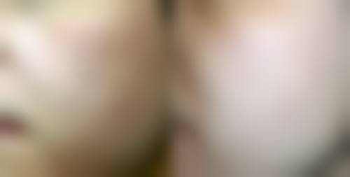 瘦脸针多久打一次成效至佳