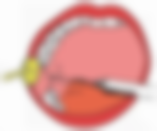 瘦脸针打完多久见效