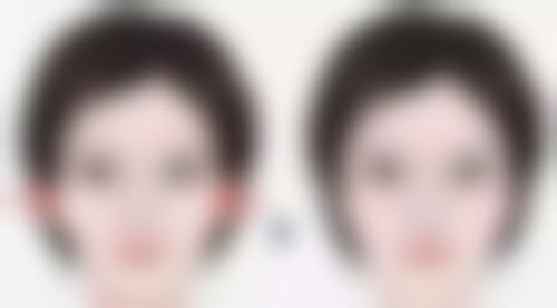 打瘦脸针的危害大吗