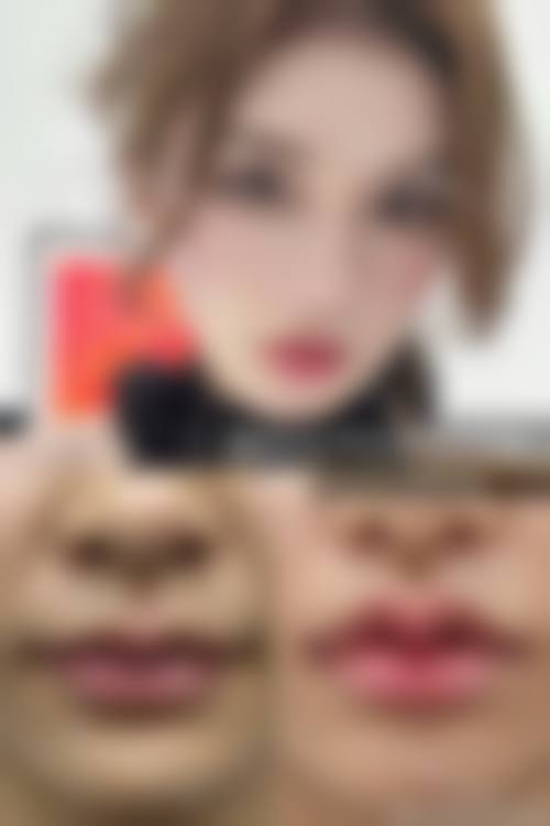 【碧莲盛·不剃发植发国内连锁（重庆分院）患者口碑评价：】