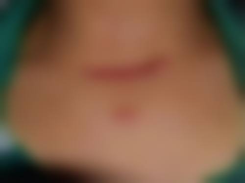 【李文学医生口碑评价】