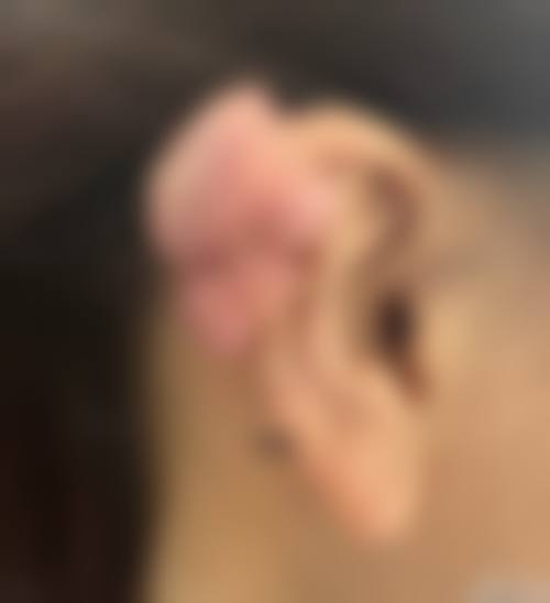 【丽水君曼医疗整形美容患者口碑评价：】