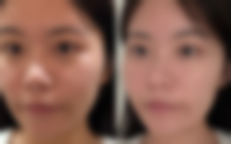 【碧莲盛·不剃发植发国内连锁（重庆分院）地址：】