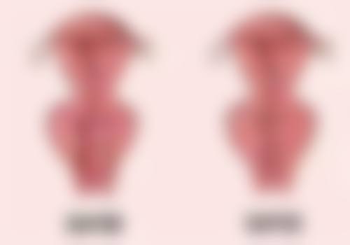 种植头发哪家医院好