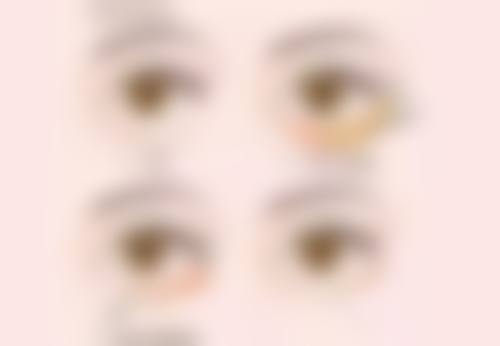 瘦脸针打了多久咬肌无力