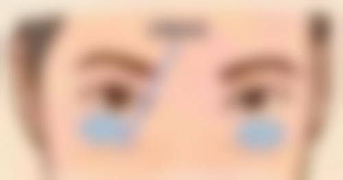 瘦脸针打完多久咬肌消失