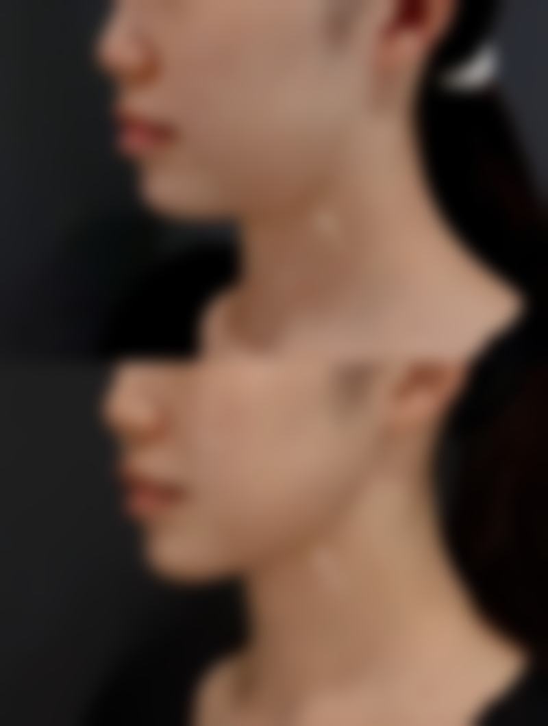 种植头发的机构有哪些？盘点5家口碑好、技术强的医美机构，助你轻松解决脱发困扰！ 