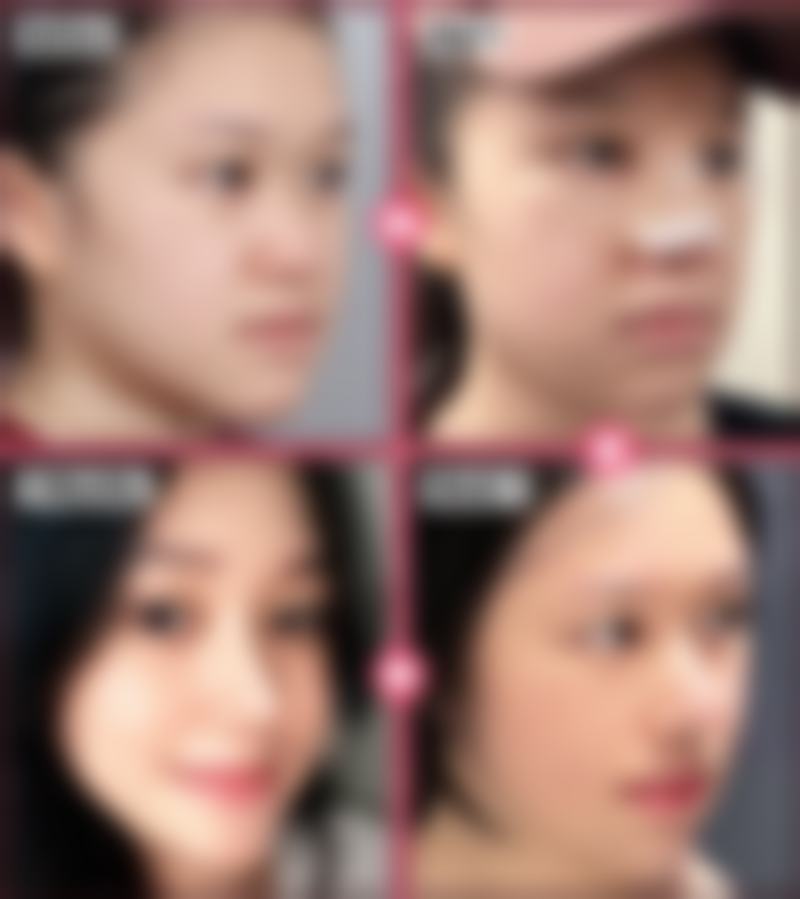 【张光辉医生口碑怎么样？】