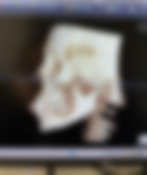 嘴唇矫正手术怎么做的