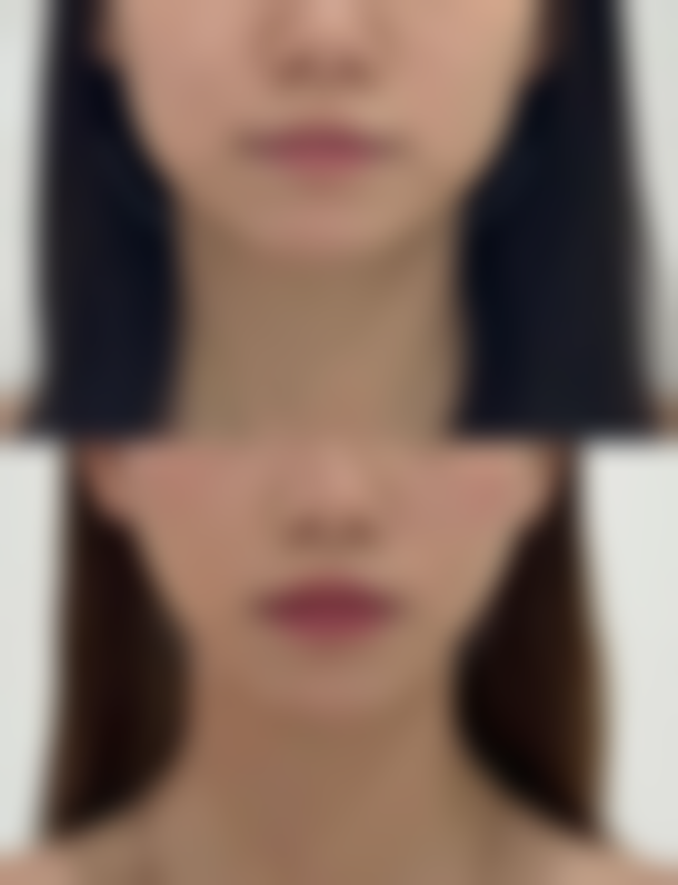 【常州沁美人医疗美容门诊部诊疗设备：】