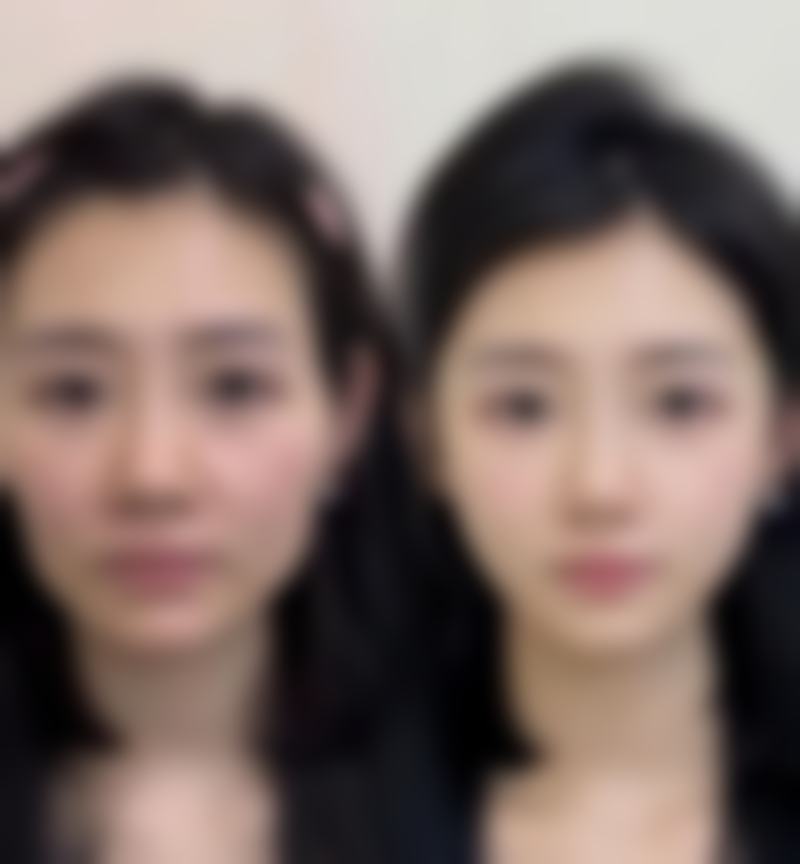 【江南maypure医院是正规的吗?】