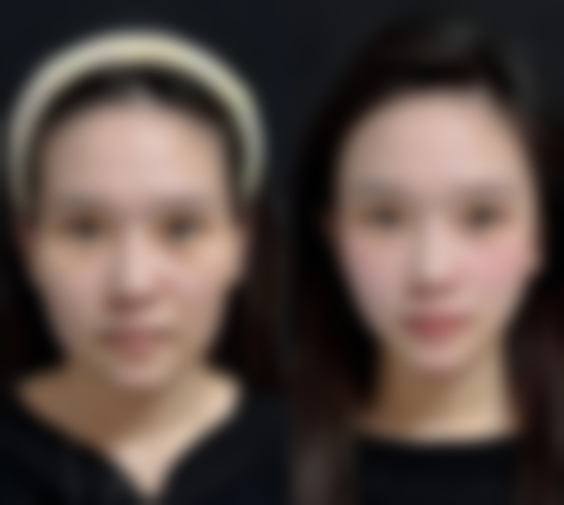 金堂熹亚花想容整形医院参考价格表：