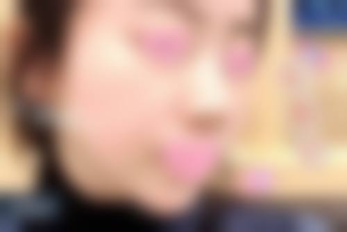 如何选择适合自己的医美产品