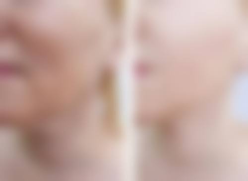 美白针打快了会吸收好吗