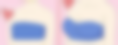 注射肉毒素除皱可以保持多久