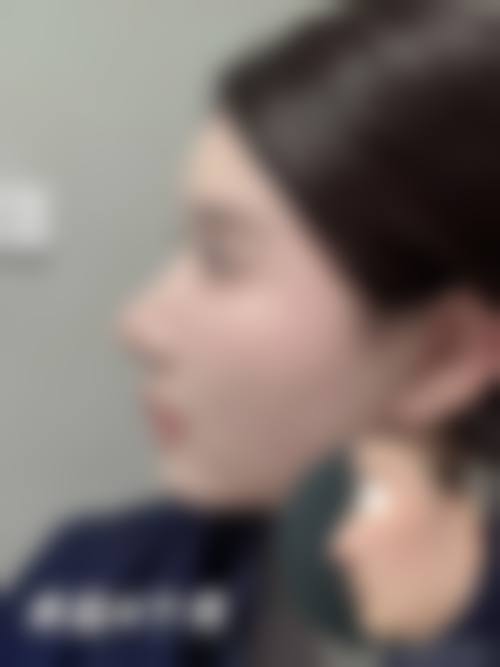 【陈琦医生擅长项目】