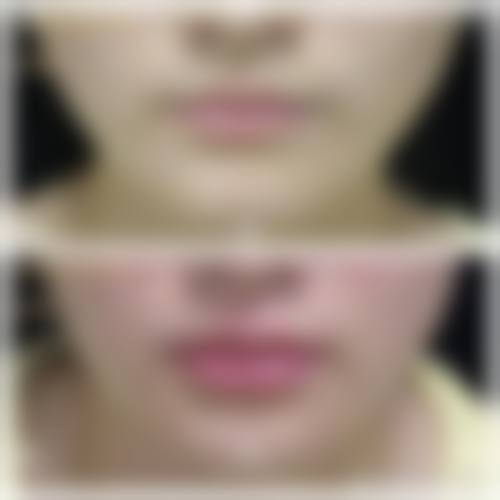 【长沙米兰柏菲医疗美容机构患者口碑评价：】