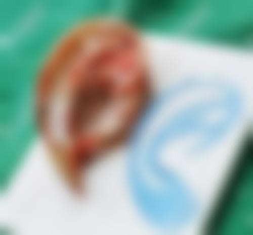 【佛山禅城屋户整形医院患者口碑评价：】