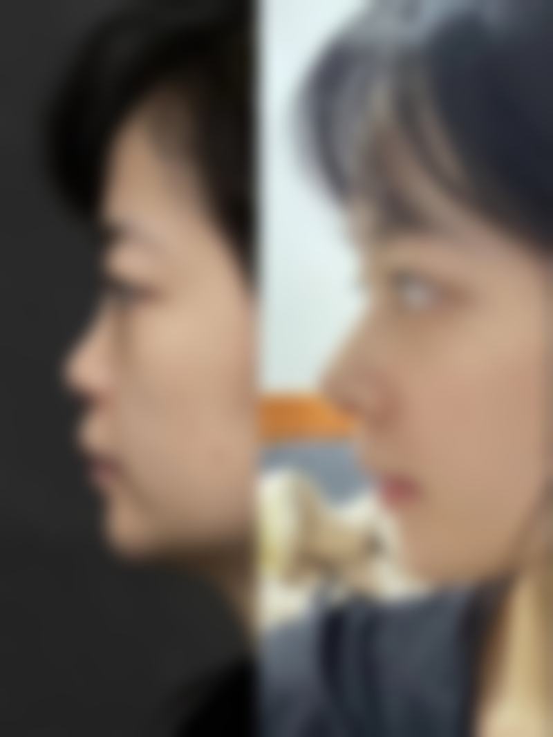 【李勇强医生口碑怎么样？】