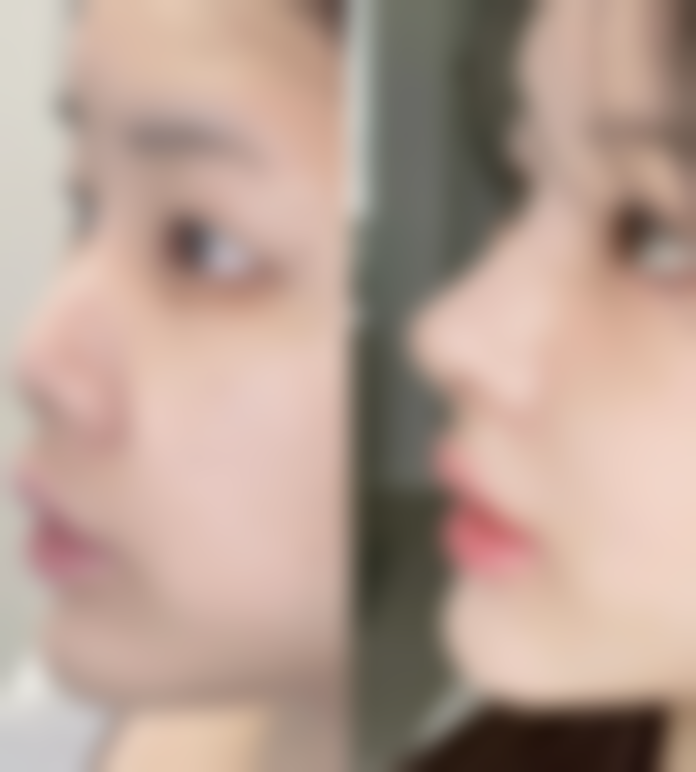 【泉州美莱华美医疗美容患者口碑评价：】